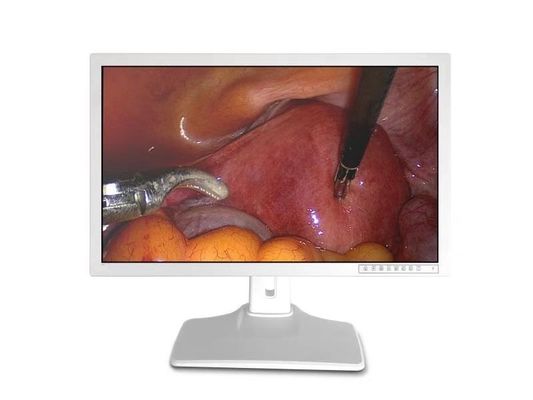 Ekran monitora endoskopu medycznego 32 cale 3840 X 2160