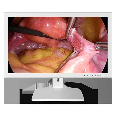 Endoskopowy monitor medyczny 1980x1200 RGBS 24 cale