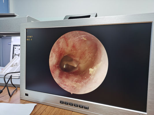 Full HD 1080P 4 w 1 Jeden zintegrowany przenośny medyczny system kamer endoskopowych