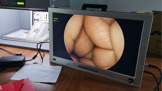 Full HD 1080P 4 w 1 Jeden zintegrowany przenośny medyczny system kamer endoskopowych